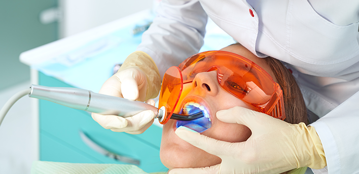 Composite Fillings treatment in Battersea - Chatfield Dental Centre