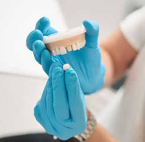 Dental Crown cost in Battersea, London