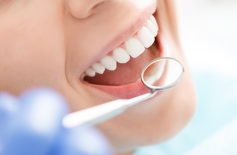 Dental Veneers Chatfield Dental Care London