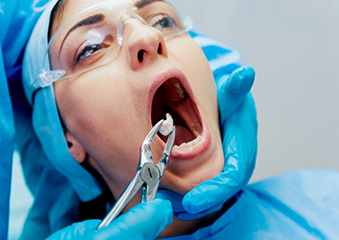 Emergency Teeth Removal London, UK