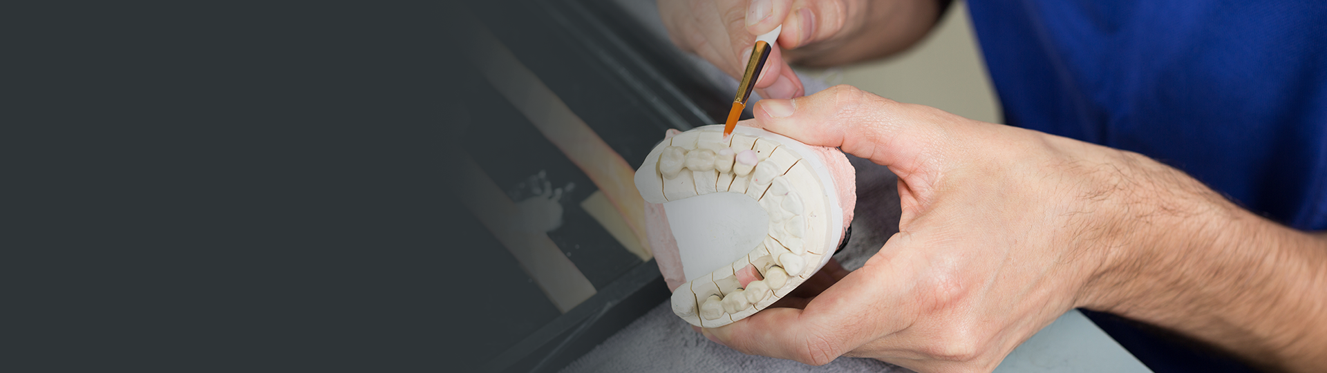 Gold Inlays Banner image – Chatfield Dental Centre
