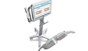 Itero Oral Scanner – Chatfield Dental Centre