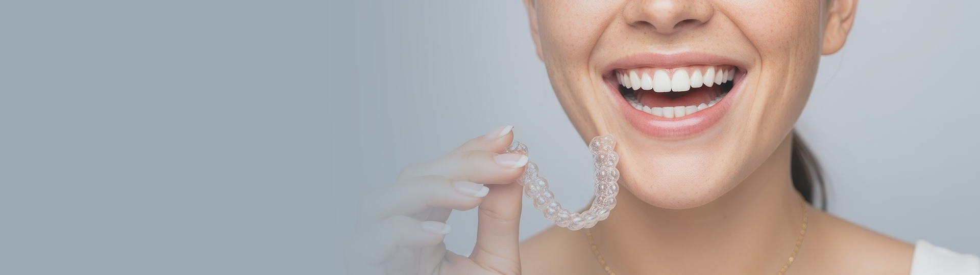 Itero Scanner banner image – Chatfield Dental Centre