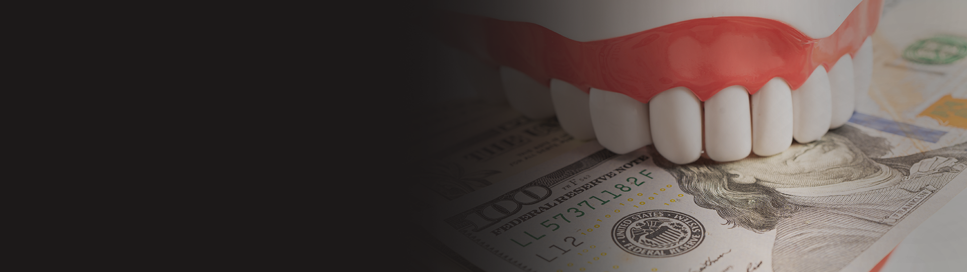 Membership Plan banner image – Chatfield Dental Centre