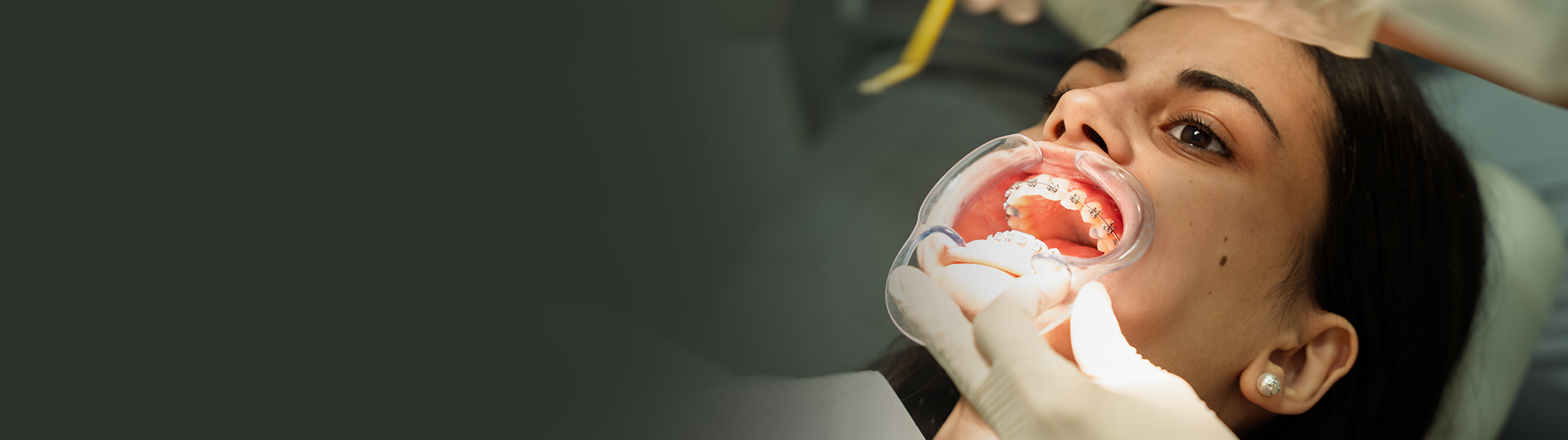 Orthodontics banner image – Chatfield Dental Centre