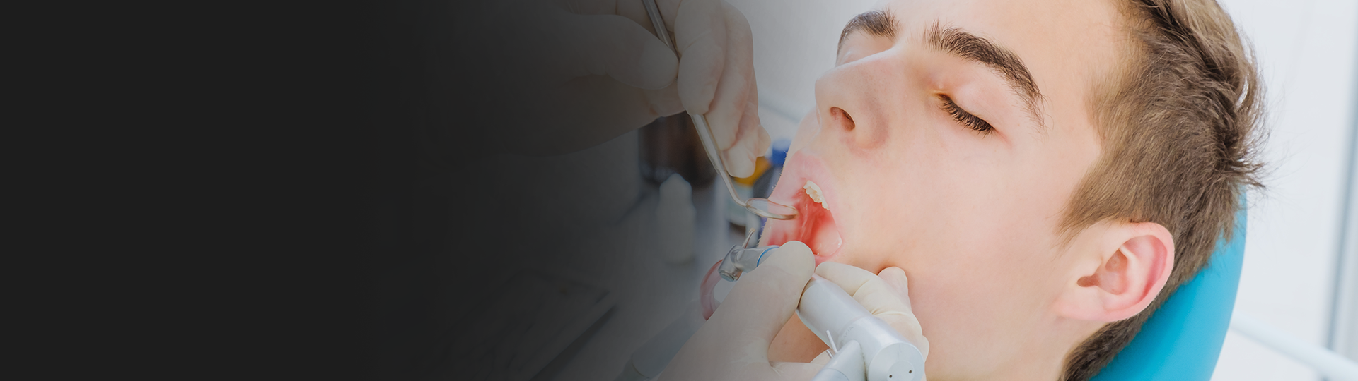 Porcelain inlays banner image – Chatfield Dental Centre