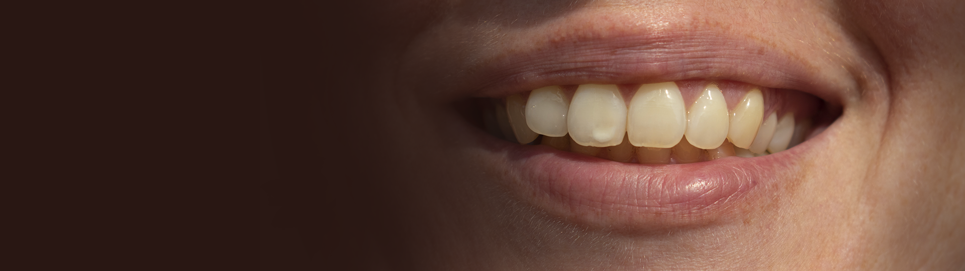Prophyflex Stain Removal banner image – Chatfield Dental Centre