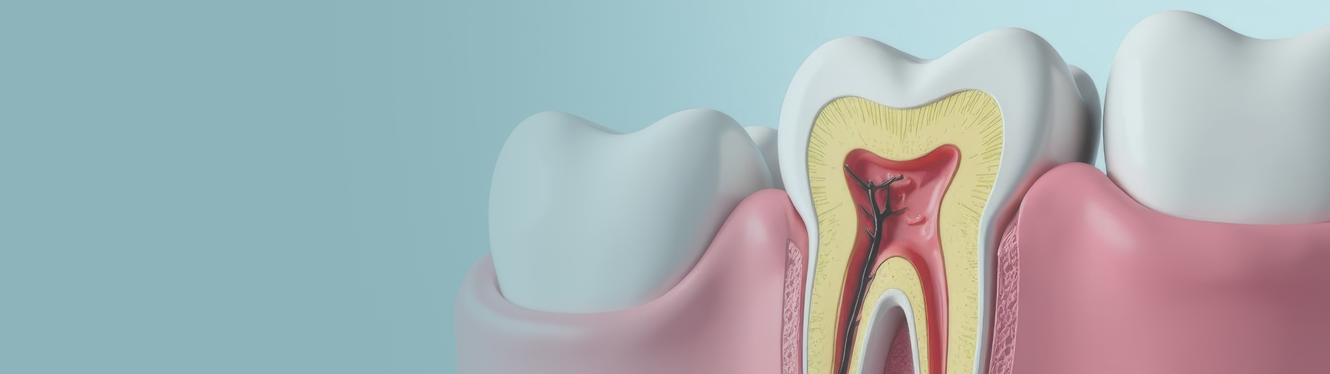 Root Canal Treatment banner image – Chatfield Dental Centre