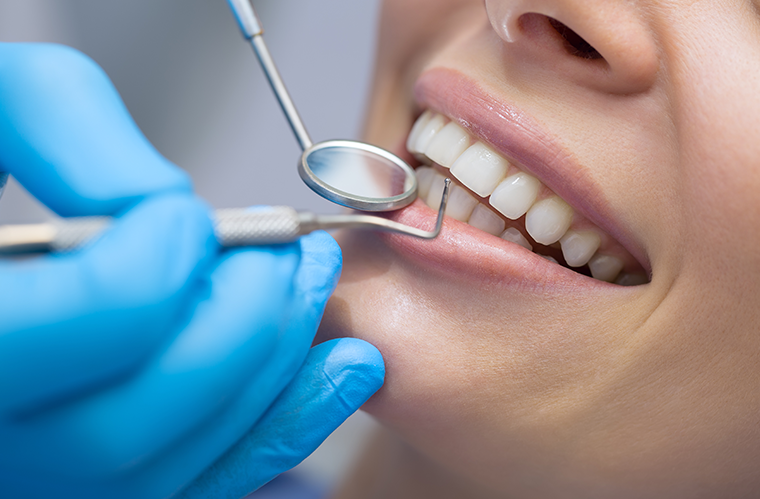 Teeth Whitening Chatfield Dental Care London