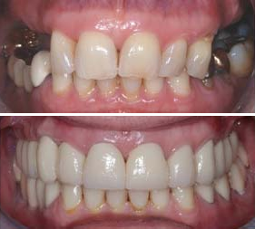 Testimonial image – Chatfield Dental Centre