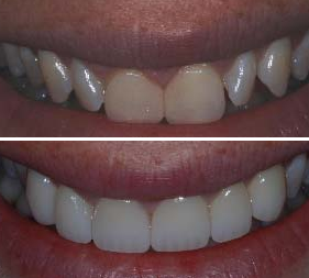 Testimonial image 2 – Chatfield Dental Centre