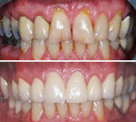Testimonial image 3 – Chatfield Dental Centre