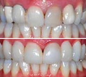Testimonial image 4 – Chatfield Dental Centre