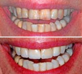 Testimonial image 5 – Chatfield Dental Centre