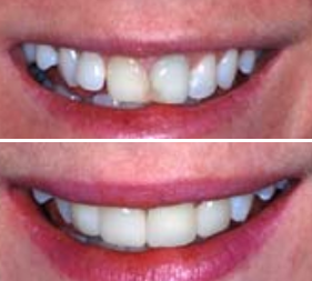 Testimonial image 6 – Chatfield Dental Centre