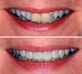 Testimonial image 7 – Chatfield Dental Centre