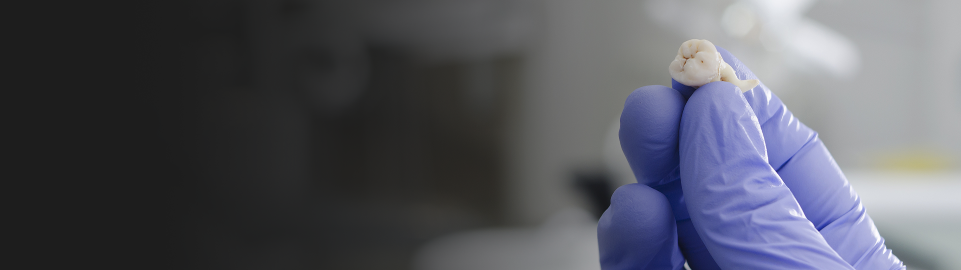 Wisdom Teeth Removal Banner Image – Chatfield Dental Centre