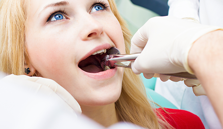 Wisdom Teeth Removal in Battersea, London