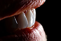 Chatfield Dental Centre Teeth Whitening thumbnail