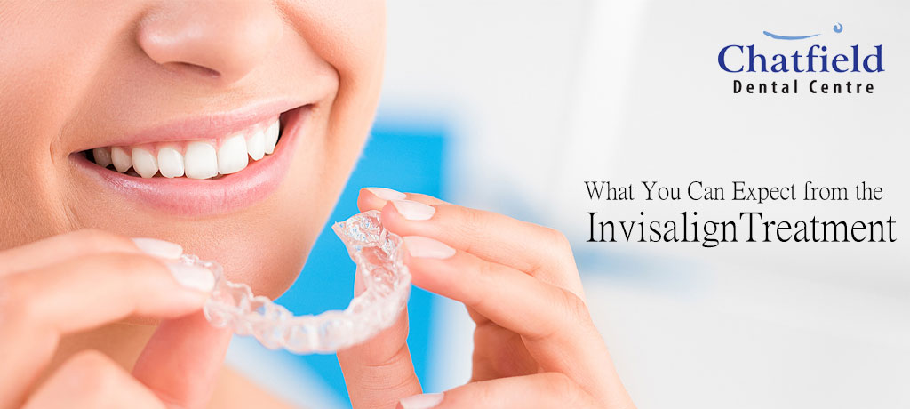What You Can Expect from the Invisalign Treatment