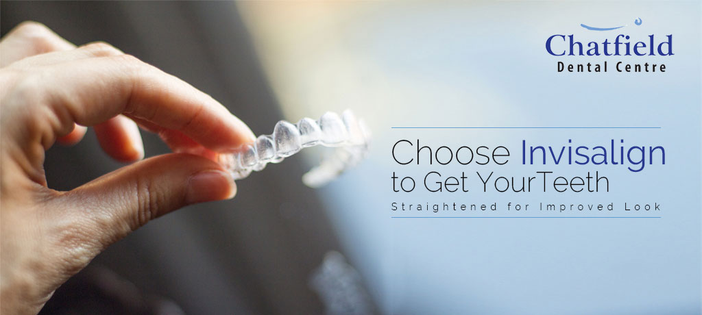 Choose Invisalign to Get Your Teeth Straightened for Improved Look